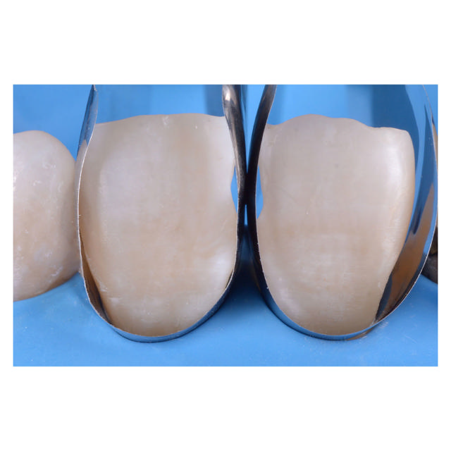 Polydentia Unica minideep Anterior matricer, 50 stk.